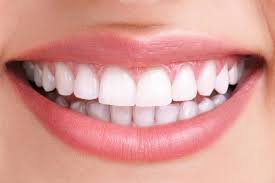 Bright white healthy smile